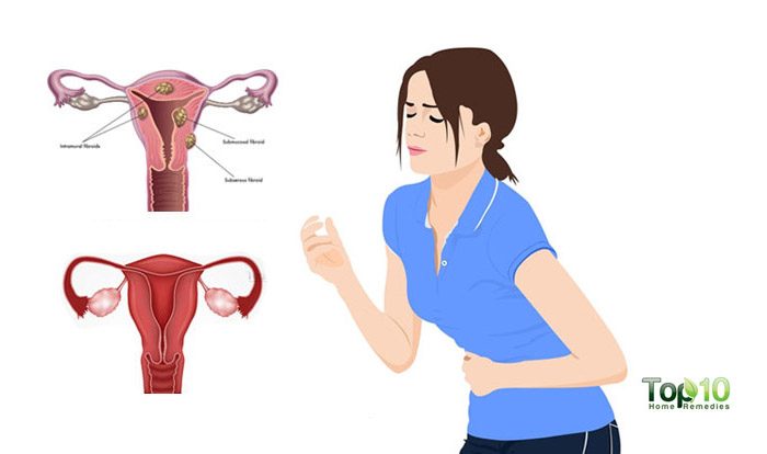 Health Problems That Your Period Indicates Top 10 Home Remedies Health Problems That Your Period Indicates Top 10 Home Remedies