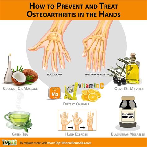 How To Prevent And Treat Osteoarthritis In The Hands And Osteoarthritis How To Prevent And Treat Osteoarthritis In The Hands And Osteoarthritis