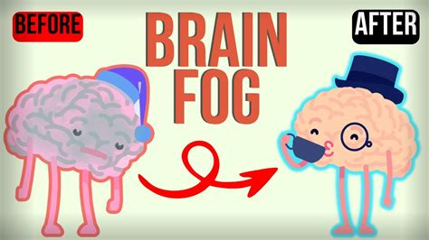 What Is Brain Fog Cause Symptoms And Cure Increase Productivity
